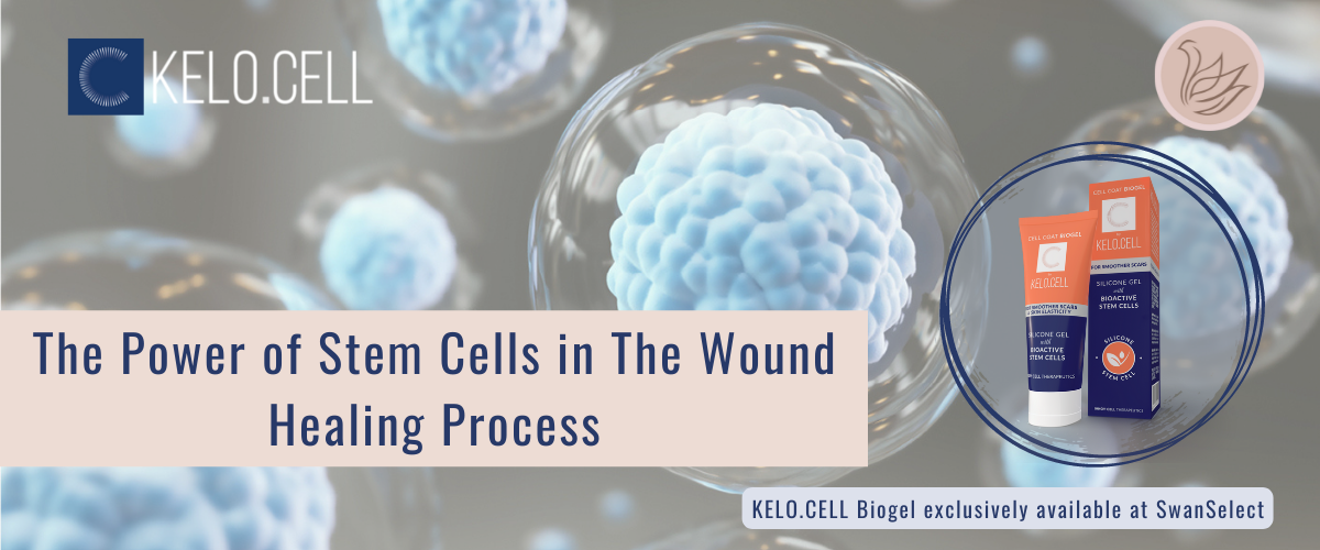The Power of Stem Cells in The Wound Healing Process