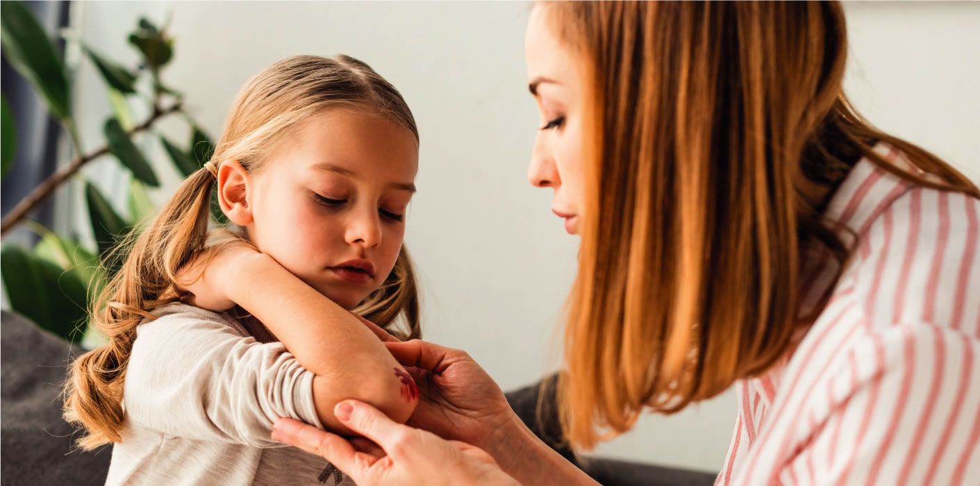 The Best Way to Treat Children's Scars